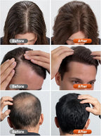 Red Light Therapy Cap for Hair
